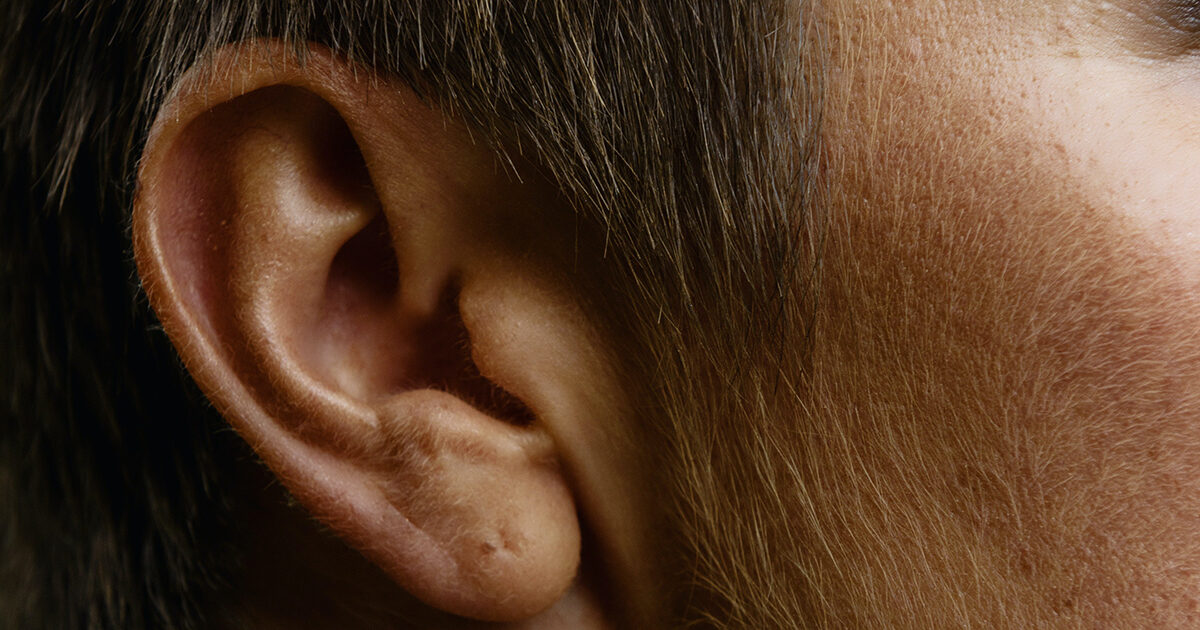 KBT kan hjälpa vid Tinnitus